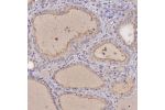 Immunohistochemical staining of human thyroid gland shows moderate positivity in apical membrane in glandular cells.