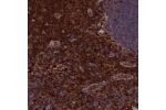 Immunohistochemical staining of human Lymph node shows strong cytoplasmic positivity in non-germinal center cells.