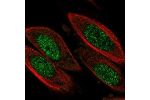 Immunofluorescent staining of human cell line PC-3 shows localization to nucleoplasm.