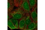 Immunofluorescent staining of human cell line MCF7 shows localization to nucleus, nucleoli, cytosol & intermediate filaments.