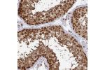 Immunohistochemical staining of human testis shows strong nuclear positivity in cells in seminiferous ducts.