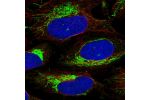 Immunofluorescent staining of human cell line U-2 OS shows localization to mitochondria.
