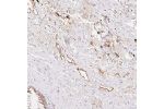 Immunohistochemical staining of human rectum shows distinct cytoplasmic positivity in lymph vessels.