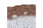 Immunohistochemical staining of human cervix, uterine shows strong cytoplasmic positivity in squamous epithelial cells.