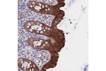 Immunohistochemical staining of human rectum shows strong cytoplasmic and membranous positivity in glandular cells.