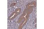 Immunohistochemical staining of human endometrium shows moderate cytoplasmic positivity in glandular cells.
