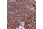 Immunohistochemical staining of human pancreas shows strong cytoplasmic positivity in exocrine glandular cells.