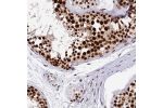 Immunohistochemical staining of human testis shows strong nuclear positivity in cells in seminiferus ducts.