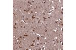 Immunohistochemical staining of human cerebral cortex shows strong cytoplasmic positivity in neurons.