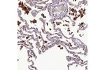 Immunohistochemical staining of human lung shows strong cytoplasmic positivity in macrophages.