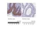 Immunohistochemistry analysis in human skin and testis tissues using HPA043104 antibody. Corresponding TACSTD2 RNA-seq data are presented for the same tissues.