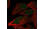 Immunofluorescent staining of human cell line RH-30 shows localization to nucleus.
