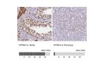 Immunohistochemistry analysis in human testis and pancreas tissues using Anti-KPNA4 antibody. Corresponding KPNA4 RNA-seq data are presented for the same tissues.
