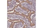 Immunohistochemical staining of human duodenum shows moderate cytoplasmic positivity in glandular cells.