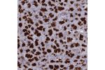 Immunohistochemical staining of human pancreas shows strong cytoplasmic positivity in exocrine glandular cells.