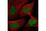 Immunofluorescent staining of human cell line U-2 OS shows localization to nucleoplasm.