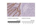 Immunohistochemistry analysis in human small intestine and pancreas tissues using HPA043207 antibody. Corresponding SLC6A19 RNA-seq data are presented for the same tissues.