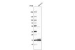 Western blot analysis in human cell line AN3-CA.