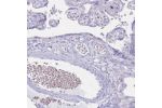Immunohistochemical staining of human placenta shows erythrocyte positivity in vessels.