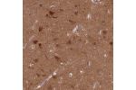 Immunohistochemical staining of human kidney shows strong cytoplasmic positivity in cells in tubules.
