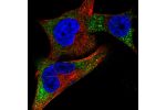 Immunofluorescent staining of human cell line SK-MEL-30 shows localization to vesicles.