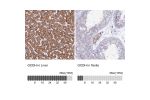 Immunohistochemistry analysis in human liver and testis tissues using HPA043252 antibody. Corresponding GCDH RNA-seq data are presented for the same tissues.