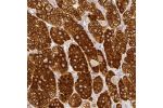 Immunohistochemical staining of human adrenal gland shows strong cytoplasmic positivity in zona glomerulosa.