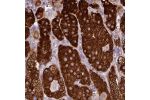 Immunohistochemical staining of human adrenal gland shows strong cytoplasmic positivity in cells in zona glomerulosa.