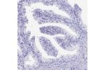Immunohistochemical staining of human prostate shows no positivity in glandular cells as expected.