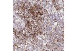Immunohistochemical staining of human adrenal gland shows strong cytoplasmic positivity in glandular cells.