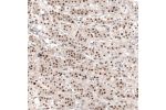 Immunohistochemical staining of human adrenal gland shows strong nuclear positivity in glandular cells in adrenal cortex.