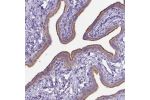 Immunohistochemical staining of human fallopian tube shows moderate membrane positivity in ciliated cells.