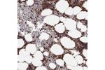 Immunohistochemical staining of human bone marrow shows strong positivity in hematopoietic cells.