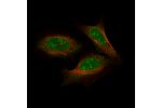 Immunofluorescent staining of human cell line U-2 OS shows localization to nucleoli, nucleoplasm and cytosol. Antibody staining is shown in green.