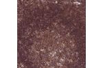 Immunohistochemical staining of human lymph node shows cytoplasmic positivity in germinal center cells and non-germinal center cells.