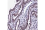 Immunohistochemical staining of human fallopian tube shows moderate nuclear positivity in glandular cells.