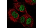 Immunofluorescent staining of human cell line U-251 MG shows localization to nucleoplasm.