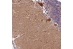 Immunohistochemical staining of human cerebellum shows strong cytoplasmic and nuclear positivity in Purkinje cells.
