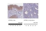 Immunohistochemistry analysis in human skin and endometrium tissues using Anti-SPTBN2 antibody. Corresponding SPTBN2 RNA-seq data are presented for the same tissues.