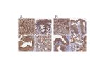 Immunohistochemical staining of human adrenal gland, colon, gallbladder and kidney using Anti-STUB1 antibody HPA043531 (A) shows similar protein distribution across tissues to independent antibody HPA041222 (B).