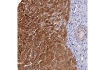 Immunohistochemical staining of human liver shows strong cytoplasmic and nuclear positivity in hepatocytes.