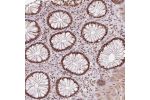 Immunohistochemical staining of human colon shows strong nuclear positivity in glandular cells.