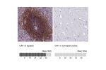 Immunohistochemistry analysis in human spleen and cerebral cortex tissues using Anti-CR1 antibody. Corresponding CR1 RNA-seq data are presented for the same tissues.