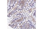 Immunohistochemical staining of human small intestine shows luminal membrane positivity in glandular cells.