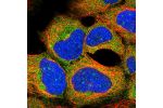 Immunofluorescent staining of human cell line HEK 293 shows localization to cytosol.
