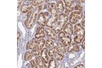 Immunohistochemical staining of human kidney shows strong cytoplasmic positivity in tubular cells.