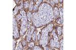 Immunohistochemical staining of human placenta shows strong cytoplasmic and membranous positivity in trophoblastic cells.