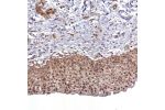 Immunohistochemical staining of human urinary bladder shows moderate cytoplasmic, membranous and nuclear positivity in urothelial cells.
