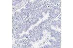 Immunohistochemical staining of human endometrium shows no positivity in glandular cells as expected.