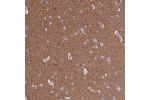 Immunohistochemical staining of human cerebral cortex shows moderate cytoplasmic positivity in neuropil.